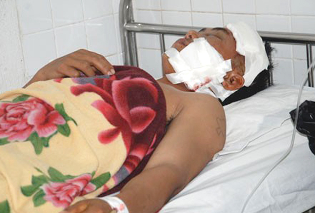 Kỳ 24: “Thần may mắn” đã mỉm cười với bệnh nhân bị xà beng đâm xuyên đầu